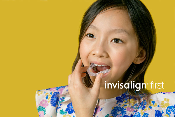 Invisalign First - Olivia